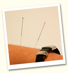Les aiguilles d'acupuncture sont fines, stériles et à usage unique